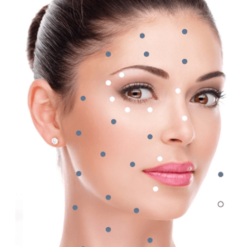 beaSkinclinic CollagenInjectionswithLineraseinLondon,Antwerp,AbujaandBeckenham
