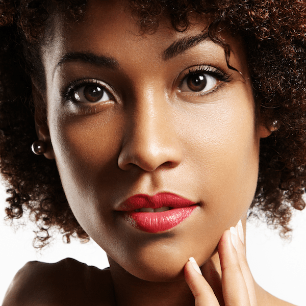 hyperpigmentation on face