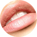 lip fillers in london