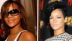 Skin Lightening In London: Lighter Skin Like Beyonce and Rihanna