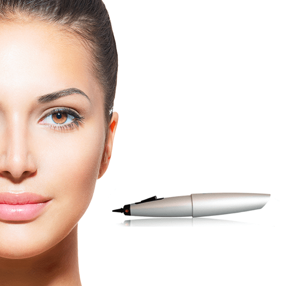 CryoPen Treatment In London | bea Skin Clinic | Call +44 