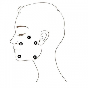 profhilo treatment uk