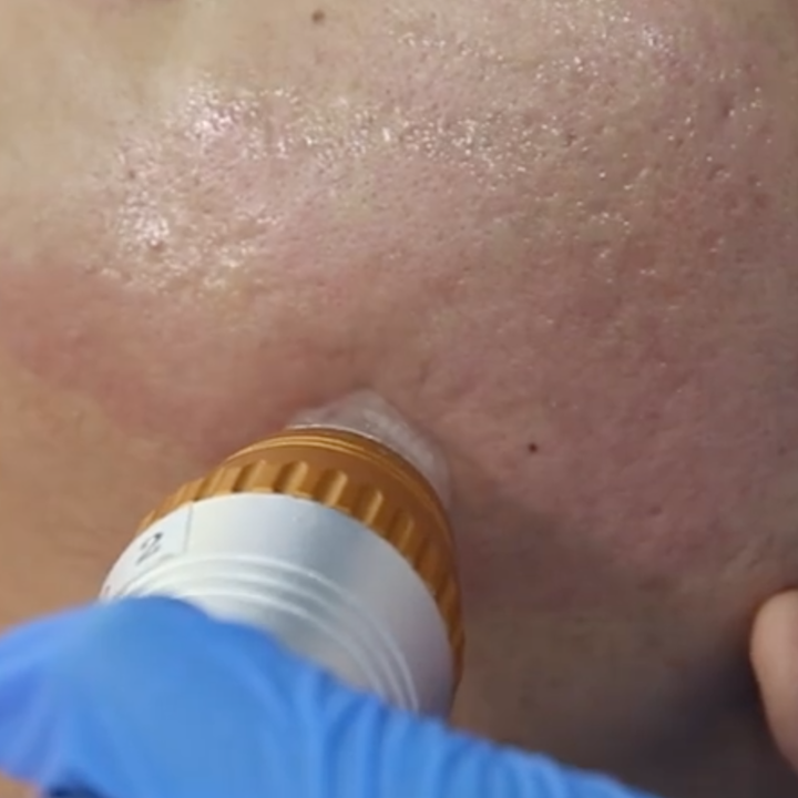 SkinMorph Placeholder – bea Skin Clinic