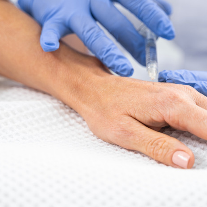 Neck, Chest, Hand Rejuvenation – bea Skin Clinic